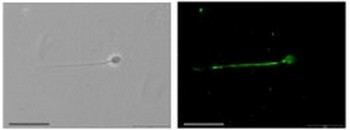 Immunofluorescence and corresponding phase-contrast images of sperm cells stainined with primary antibody against SCN10A and Nax showing specific localizations for each Na+ channel