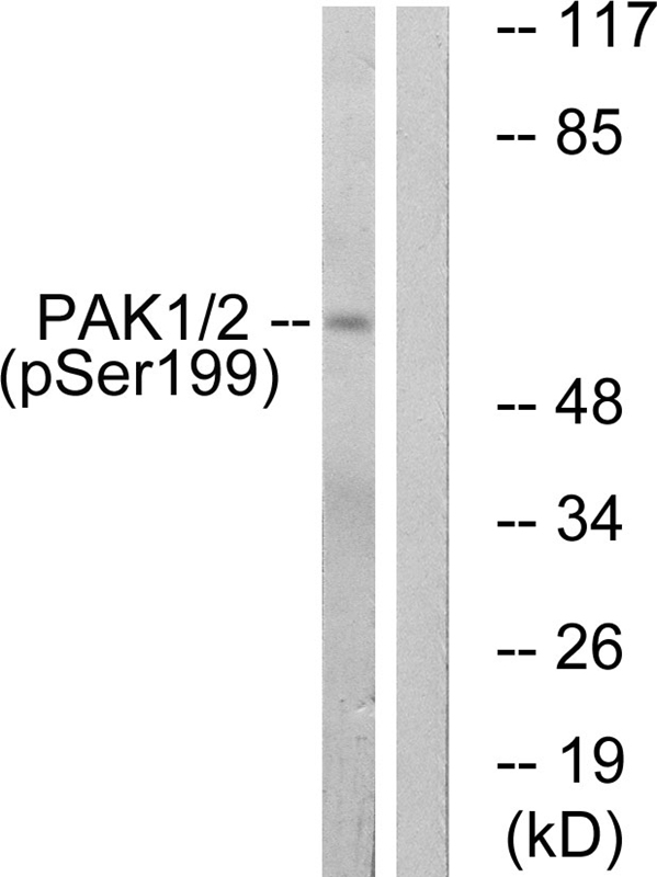 Western blot analysis of GRP78 in (from L-R): Recombinant protein, human, dog and mouse tissues using a 1:1000 dilution of TA309341.