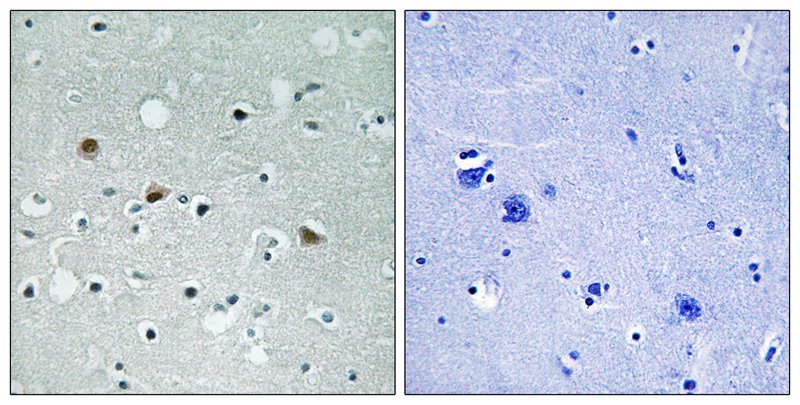 Western Blot: CDR2 Antibody - Western blot analysis of CDR2 antibody on HeLa whole cell using anti-CDR2.