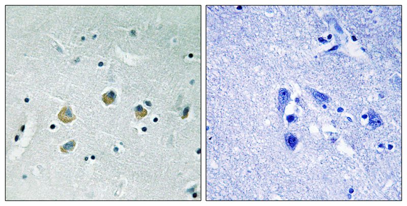 Specificity of polyclonal antibodies against ch-TOGp. Total cell protein (;50 mg) from human HeLa cells was immunoblotted with a rabbit polyclonal serum generated against the C-terminal 301 amino acids of the ch-TOGp.