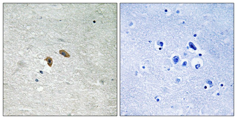 Western Blot: GAP43 Antibody - Western blot analysis of GAP43 in human brain protein using anti-GAP43.