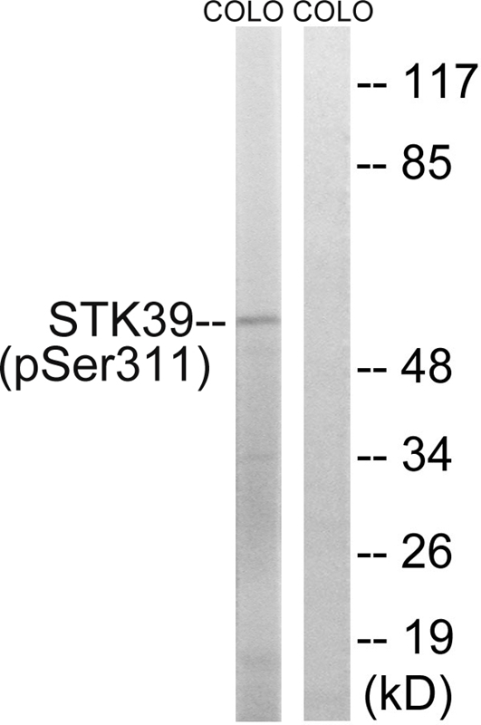 Western Blot: Glutathione Peroxidase 3 Antibody - WB analysis of GPX3 in human kidney lysate.