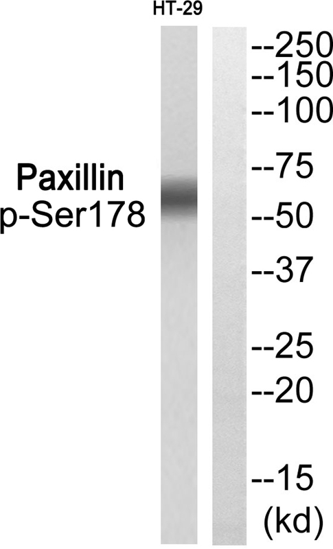 Western Blot: Ogg1 antibody - 1, 5, 10 ng titration of human recombinant Ogg1 protein, detected by anti-Ogg1.