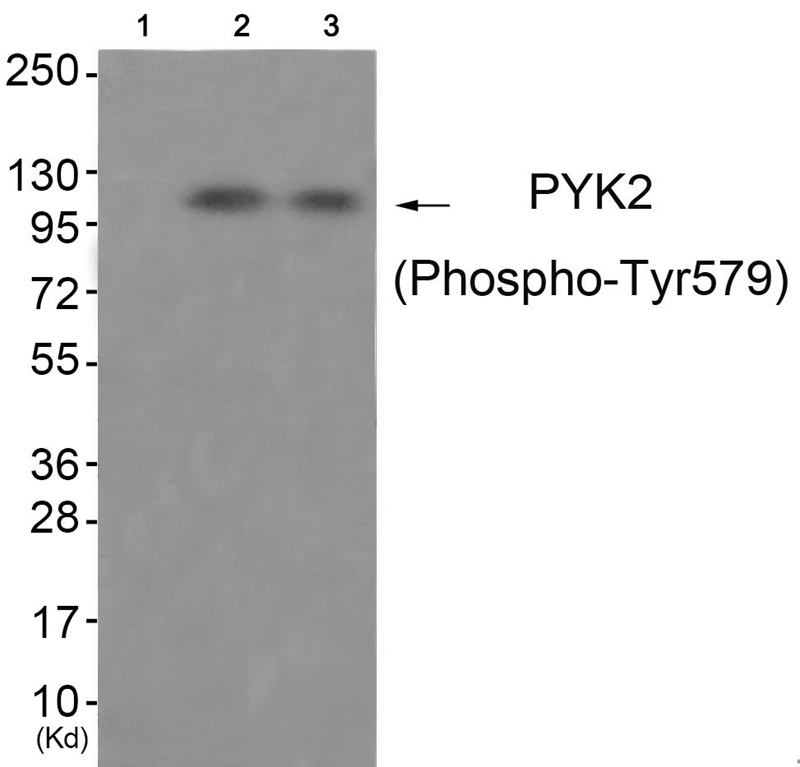 Western Blot: Pyruvate Carboxylase Antibody - Western blot analysis of Pyruvate Carboxylase in A. Human liver extracts and B. Mouse liver extracts using TA309794.