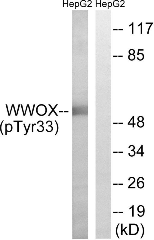 Western Blot: Perilipin Antibody -WB detection of Perilipin in human liver samples.
