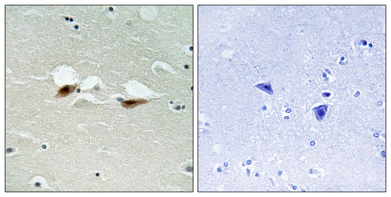 Western Blot: SEMA3B Antibody - Detection of SEMA 3B in mouse E16 cerebellum lysate. ECL exposure, 1 minute.
