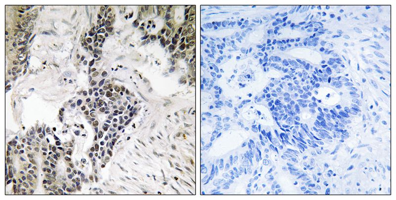 The photo on the left is antibody staining of hCTR1 overexpressing cell line. The photo on the right is antibody plus peptide competition staining.