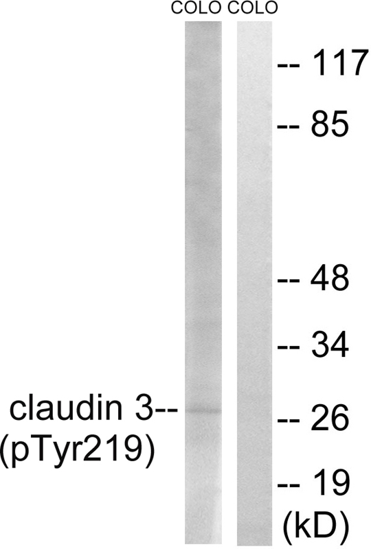 Western Blot: SLIRP Antibody - Detection of SLIRP protein in a human liver. Primary was used at 0.6ug/ml.