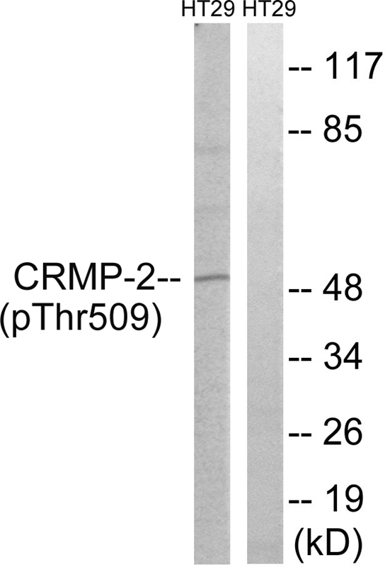 Western Blot: SCP3 Antibody - Western blot analysis of SCP3 in mouse testis protein using anti-SCP3.
