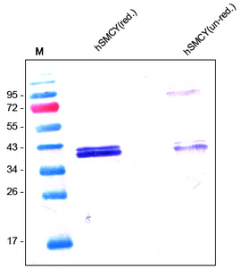 Western analysis of recombinant human SMCY (Cat.-No AR60001PU-N) using anti-human SMCY / JARID1D polyclonal antibody Cat.-No. AP60001PU-N directed against the C-terminal part of human SMCY (Leu1248-Leu1539).