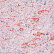 Formalin-fixed, paraffin-embedded human brain stained with Microtubule-Associated Protein 2a, b Ab using peroxidase-conjugate and AEC chromogen. Note cytoplasmic staining of the neurons and dendrites.