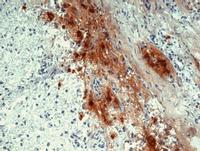 (2ug/ml) staining of NIH3T3 lysate (35ug protein in RIPA buffer). Primary incubation was 1 hour. Detected by chemiluminescence.