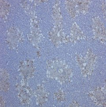 (2.5ug/ml) staining of paraffin embedded Human Lung. Steamed antigen retrieval with citrate buffer pH 6, AP-staining.