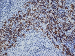 Staining of ED2 antibody on Rat spleen (frozen section).