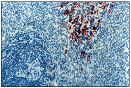 AMC Staining of Rat spleen sections using Ki-M2R antibody (frozen section) Cat.No.BM4003