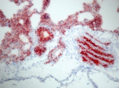 Immunohistochemistry: SP-D antibody (Clone: VIF11) staining of Rat Lung Frozen Section