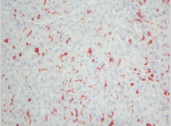 F4/80 Antigen antibody staining of Mouse Liver Frozen Section.