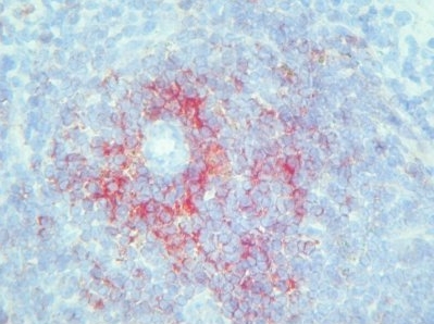 Mouse Spleen Frozen Section stained with CD205 Antibody (Clone NLDC-145).