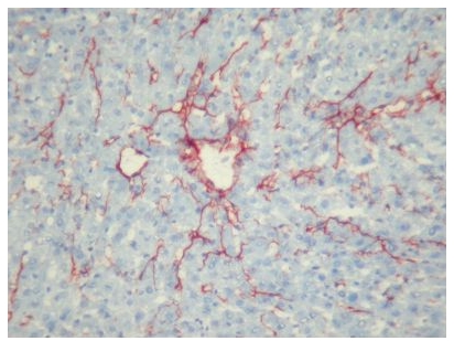 Immunohistochemistry on Mouse Liver Frozen Sections using Fibroblast Antibody Cat.-No BM4018 clone ER-TR7.