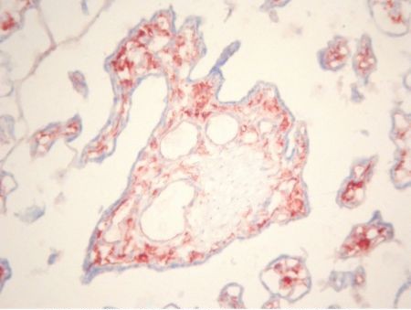 CD163 antibody staining of Human Placenta Frozen Section.