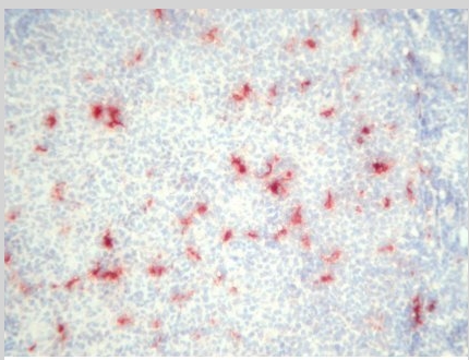 Figure 1. Immunohistochemistry on human tonsil frozen sections using antibody BM4022.