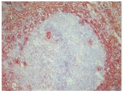 Human Tonsil Frozen Section stained with S100A8/9 Antibody Cat.-No BM4025 (Clone 27E10).