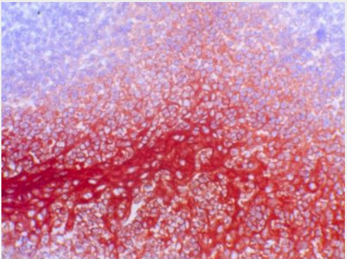 Human Tonsil Frozen Section stained with Biotin conjugated S100A8/9 Antibody Cat.-No BM4025B (Clone 27E10).