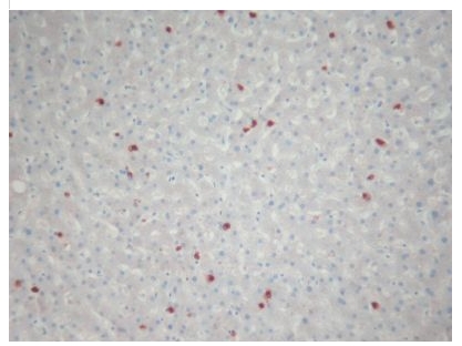 Immunohistochemical staining on Human Liver Paraffin Sections using S100A9 antibody clone S36.48