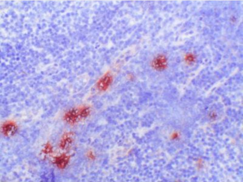 Human tonsil Frozen section stained with Biotin conjugated S100A9 / Calgranulin-B / MRP14 Antibody