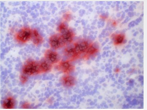 Immunohistochemical staining on Human Tonsil Frozen Sections using S100A9 antibody clone S32.2