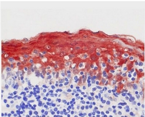 Immunohistochemistry on Human Tonsil Paraffin Sections using S100A8 antibody clone 8-5C2.