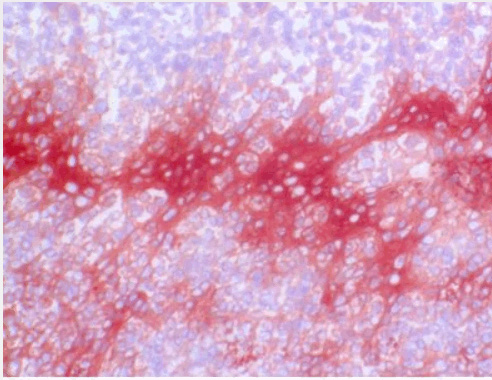 Calgranulin-A / MRP8 antibody staining of Human Tonsil Frozen Section.