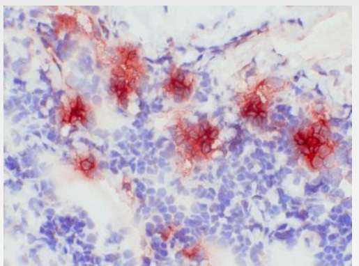 Frozen Section of Human Tonsil stained with S100A8 Antibody Clone S13.67