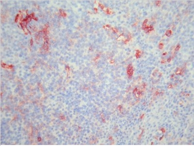 CD11b antibody staining of Human Tonsil Frozen Section.