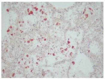 CD163 antibody staining of Paraffin Human Lung Section (Clone 5C6-FAT)