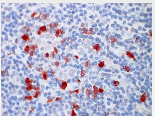 Human Tonsil, Frozen Section stained with CD120a antibody clone Utr9