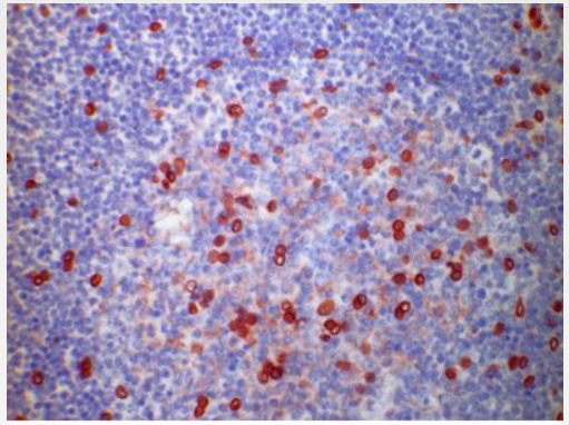 Human Tonsil, Frozen Section stained with CD120a antibody clone Utr9