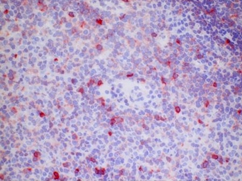 Human Tonsil, Frozen Section stained with CD120b antibody clone Utr1