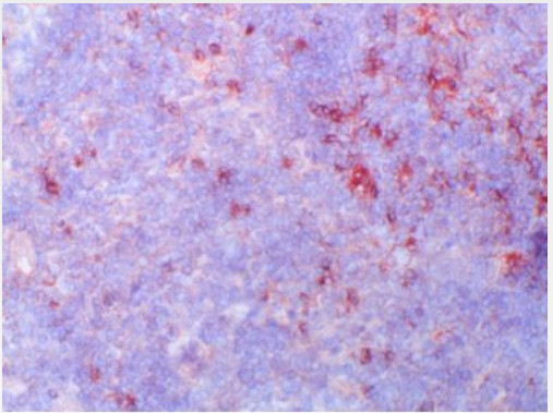 Human Tonsil Frozen Section stained with Biotin conjugated CD120b / TNFR2 antibody (Clone utr1).