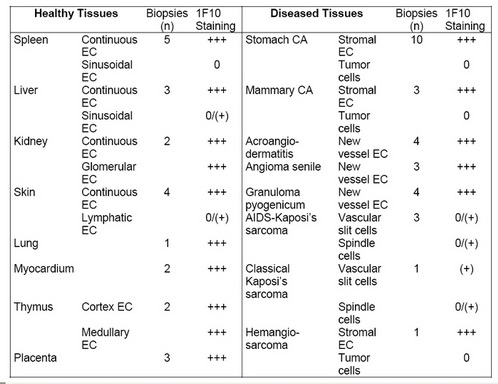 Table 1. Distribution of 1F10 antigen in normal and tumor tissues.