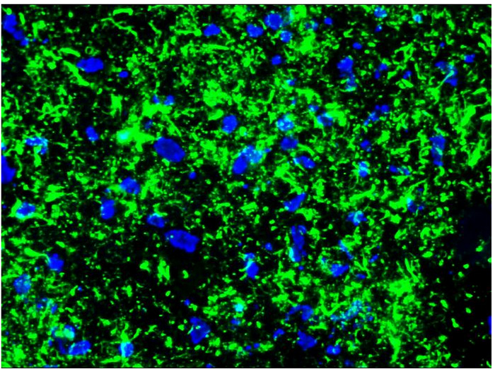 Immunohistochemistry on Frozen Section of Rat brain.