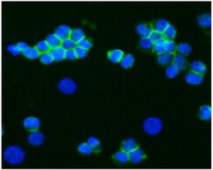 Immunostaining of the neural cell adhesion molecule (NCAM) in small cell lung cancer cell line NCI-H82