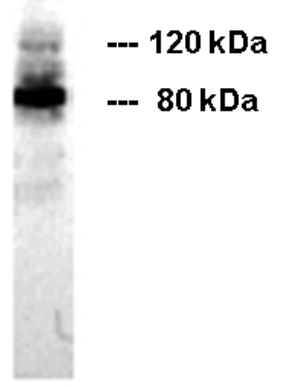 Western blot on MCF-7 cellular extract: moderate reactivity with the 120 kDa full length protein and strong reactivity with the 80 kDa extracellular part of E-Cadherin.