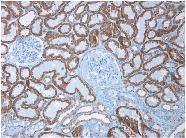 Immunohistochemistry on Paraffin Section of Human kidney