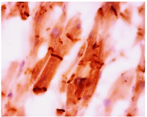 Immunohistochemistry on Paraffin Section of Human heart.