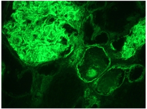 Immunohistochemistry on frozen section of Human kidney.