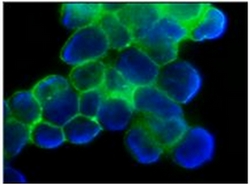 Immunostaining of Human ovarian carcinoma cells (cell line:OVCAR-3)