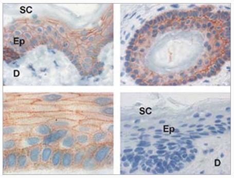 Immunohistochemical detection of Plakophilin-3 in Paraffin Sections of Formalin-Fixed Human skin using monoclonal antibody 23E3/4. SC = Stratum Corneum Ep = Epidermis D = Dermis