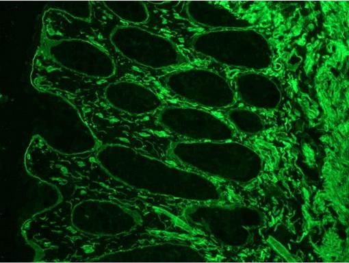 Immunofluorescence staining of Frozen Sections from Human colon (methanol fixed) using BM6046P, showing the localization of laminin in the connective tissue and in basement membranes surrounding the epithelial crypts.