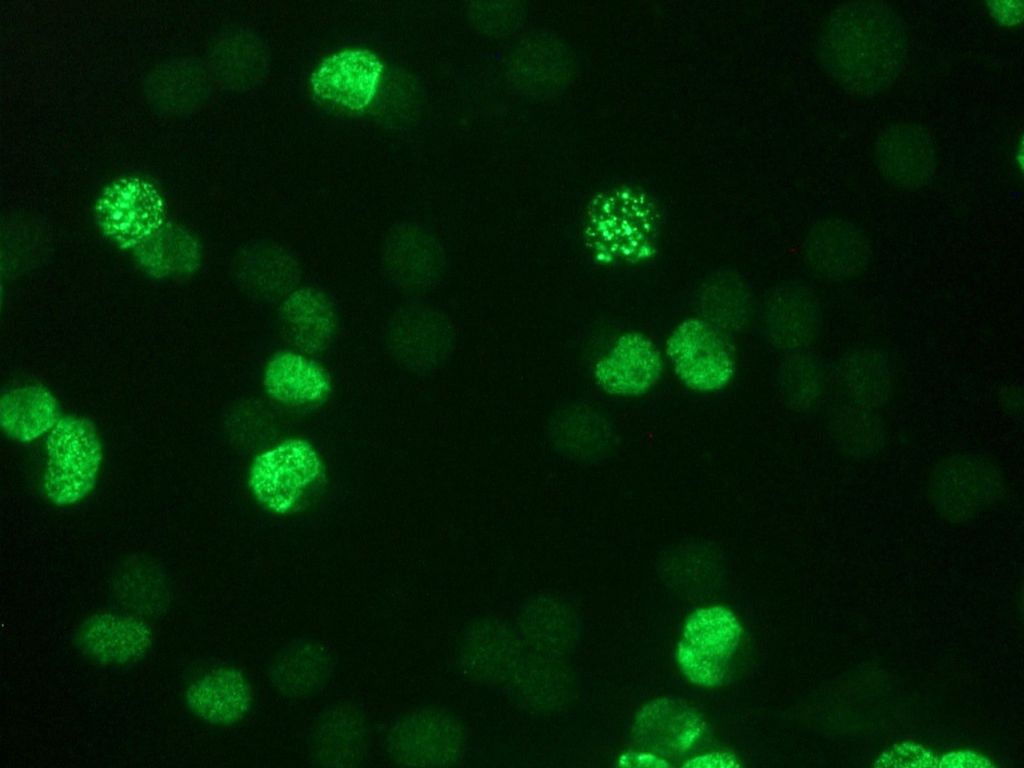 Indirect immunofluorescence staining of BrdU-labeled MR65 lung cancer cells using BM6048P (IIB5)